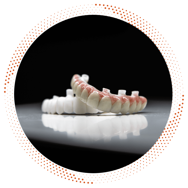 full mouth implants