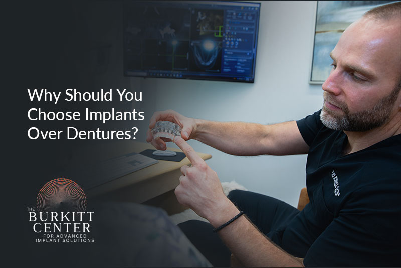 why choose implants mv jones